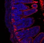 LYZ Antibody in Immunohistochemistry (Paraffin) (IHC (P))