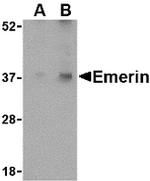 Emerin Antibody in Western Blot (WB)