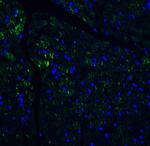 IL-17A Antibody in Immunohistochemistry (Paraffin) (IHC (P))