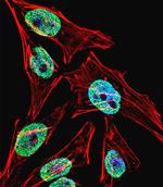 TERT Antibody in Immunocytochemistry (ICC/IF)