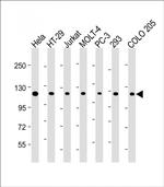 TERT Antibody in Western Blot (WB)