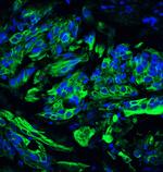 TET2 Antibody in Immunohistochemistry (Paraffin) (IHC (P))