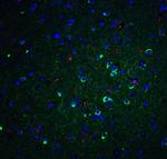 APOE Antibody in Immunohistochemistry (Paraffin) (IHC (P))