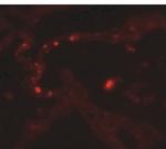 MMP9 Antibody in Immunohistochemistry (Paraffin) (IHC (P))