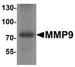 MMP9 Antibody in Western Blot (WB)