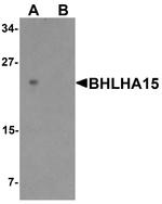 Mist1 Antibody in Western Blot (WB)