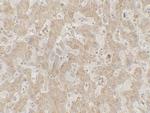 CCR7 Antibody in Immunohistochemistry (Paraffin) (IHC (P))