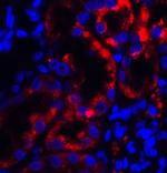 TRPV4 Antibody in Immunohistochemistry (Paraffin) (IHC (P))