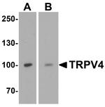 TRPV4 Antibody in Western Blot (WB)