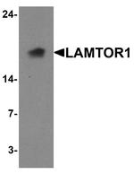 LAMTOR1 Antibody in Western Blot (WB)