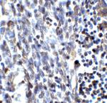 SMURF2 Antibody in Immunohistochemistry (Paraffin) (IHC (P))