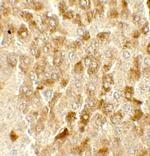 SMURF2 Antibody in Immunohistochemistry (Paraffin) (IHC (P))