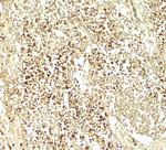 E2F3 Antibody in Immunohistochemistry (Paraffin) (IHC (P))