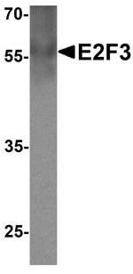 E2F3 Antibody in Western Blot (WB)