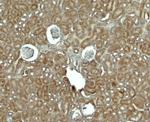 RhoG Antibody in Immunohistochemistry (Paraffin) (IHC (P))