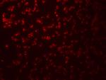 SAMHD1 Antibody in Immunocytochemistry (ICC/IF)