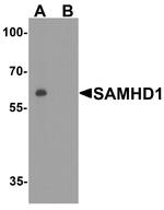 SAMHD1 Antibody in Western Blot (WB)