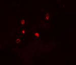 ATG4D Antibody in Immunohistochemistry (Paraffin) (IHC (P))