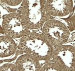 ATG4D Antibody in Immunohistochemistry (Paraffin) (IHC (P))