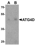 ATG4D Antibody in Western Blot (WB)