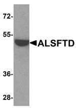 C9orf72 Antibody in Western Blot (WB)