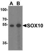 SOX10 Antibody in Western Blot (WB)