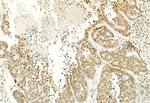 H3K4me3 Antibody in Immunohistochemistry (Paraffin) (IHC (P))