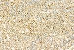 H3K4me3 Antibody in Immunohistochemistry (Paraffin) (IHC (P))