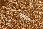 H3K4me3 Antibody in Immunohistochemistry (Paraffin) (IHC (P))