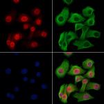 Phospho-4EBP1 (Thr37, Thr46) Antibody in Immunocytochemistry (ICC/IF)