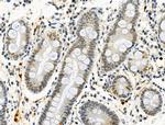 Phospho-4EBP1 (Thr37, Thr46) Antibody in Immunohistochemistry (Paraffin) (IHC (P))