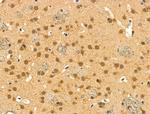 Phospho-4EBP1 (Thr37, Thr46) Antibody in Immunohistochemistry (Paraffin) (IHC (P))