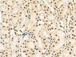 Phospho-4EBP1 (Thr37, Thr46) Antibody in Immunohistochemistry (Paraffin) (IHC (P))