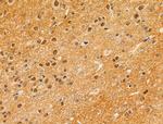 Phospho-4EBP1 (Thr37, Thr46) Antibody in Immunohistochemistry (Paraffin) (IHC (P))