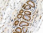 Phospho-4EBP1 (Thr37, Thr46) Antibody in Immunohistochemistry (Paraffin) (IHC (P))