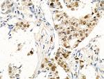 Phospho-4EBP1 (Thr37, Thr46) Antibody in Immunohistochemistry (Paraffin) (IHC (P))