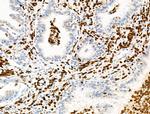 Phospho-4EBP1 (Thr37, Thr46) Antibody in Immunohistochemistry (Paraffin) (IHC (P))