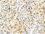 Phospho-4EBP1 (Thr37, Thr46) Antibody in Immunohistochemistry (Paraffin) (IHC (P))