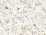 Phospho-4EBP1 (Thr37, Thr46) Antibody in Immunohistochemistry (Paraffin) (IHC (P))