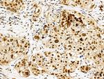 Phospho-4EBP1 (Thr37, Thr46) Antibody in Immunohistochemistry (Paraffin) (IHC (P))