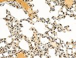 Phospho-4EBP1 (Thr37, Thr46) Antibody in Immunohistochemistry (Paraffin) (IHC (P))