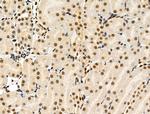 Phospho-4EBP1 (Thr37, Thr46) Antibody in Immunohistochemistry (Paraffin) (IHC (P))