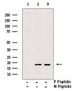 Phospho-4EBP1 (Thr37, Thr46) Antibody in Western Blot (WB)