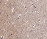 Phospho-ABL1/ABL2 (Tyr393, Tyr439) Antibody in Immunohistochemistry (Paraffin) (IHC (P))