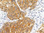 Phospho-Catenin alpha-1 (Ser655, Thr658) Antibody in Immunohistochemistry (Paraffin) (IHC (P))