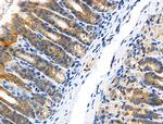 Phospho-Catenin alpha-1 (Ser655, Thr658) Antibody in Immunohistochemistry (Paraffin) (IHC (P))