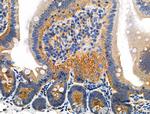 Phospho-Catenin alpha-1 (Ser655, Thr658) Antibody in Immunohistochemistry (Paraffin) (IHC (P))