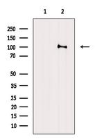 Phospho-Catenin alpha-1 (Ser655, Thr658) Antibody in Western Blot (WB)