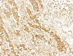 Phospho-AMPK alpha-1,2 (Thr172) Antibody in Immunohistochemistry (Paraffin) (IHC (P))