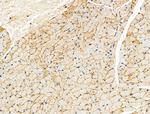 Phospho-AS160 (Ser588) Antibody in Immunohistochemistry (Paraffin) (IHC (P))